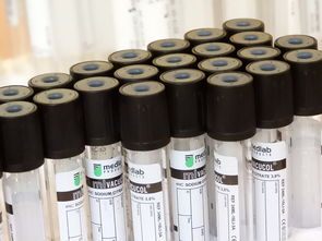 揭秘最新生物测量仪品牌，科技革新，健康管理的得力助手